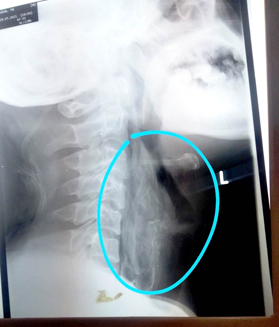 Papuyu Tersangkut di Tenggorokan Mancing Mania