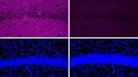 how-to-prevent-alzheimers-and-parkinsons-disease_63ac3b594.jpg